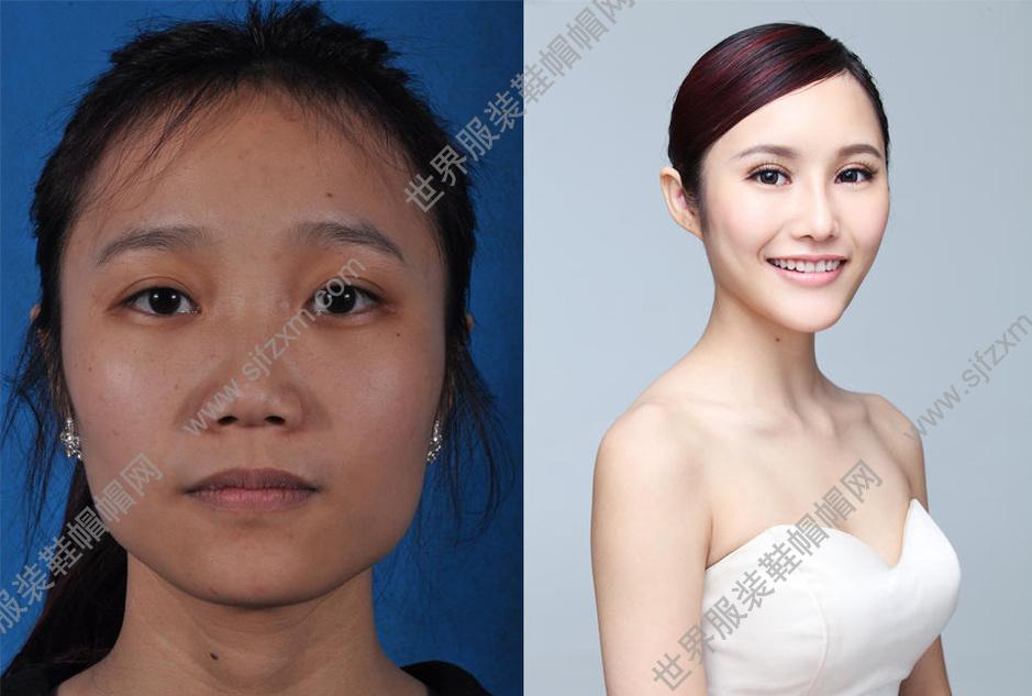 多名女子整容前后对比照