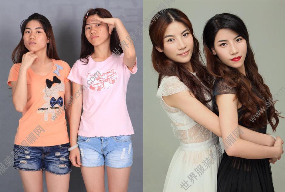 多名女子整容前后对比照